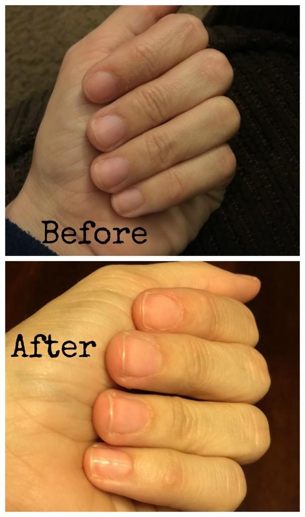 Nails